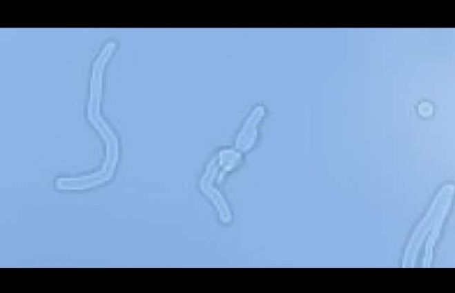 O que são esses 'bichinhos' que flutuam no olho da gente? Saiba o que são as moscas volantes