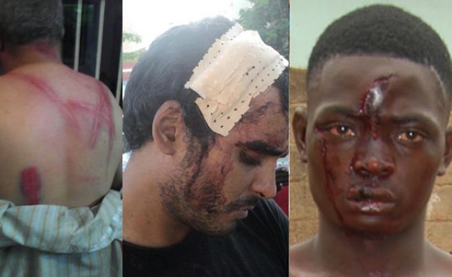 Procurador destaca importância da observância dos Direitos Humanos