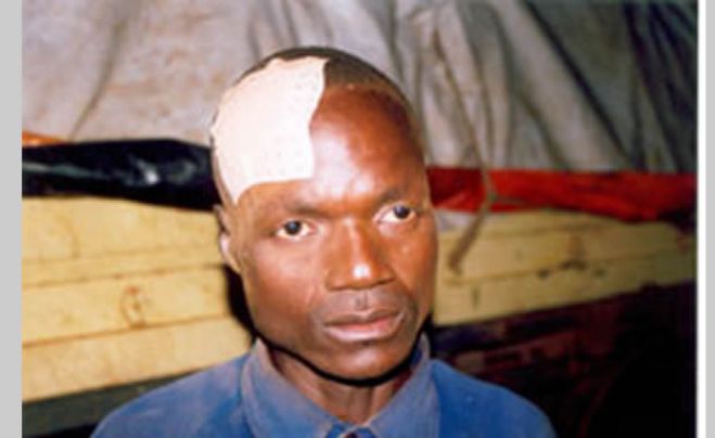 Intolerância Política no Ucuma tem o rosto da Polícia Nacional e do MPLA