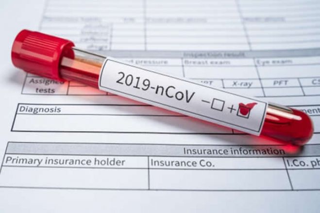 Covid-19: Angola regista mais 4 casos e eleva para 14 o número de pessoas infectadas