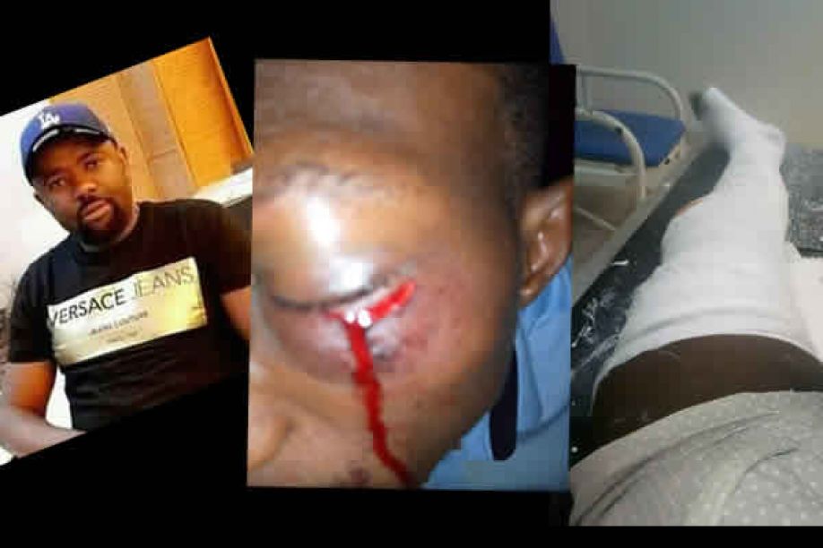 Empresário Ricardo Ngandanga marido de Jessica Pit Bull manda invadir e espancar família do músico Killankasca