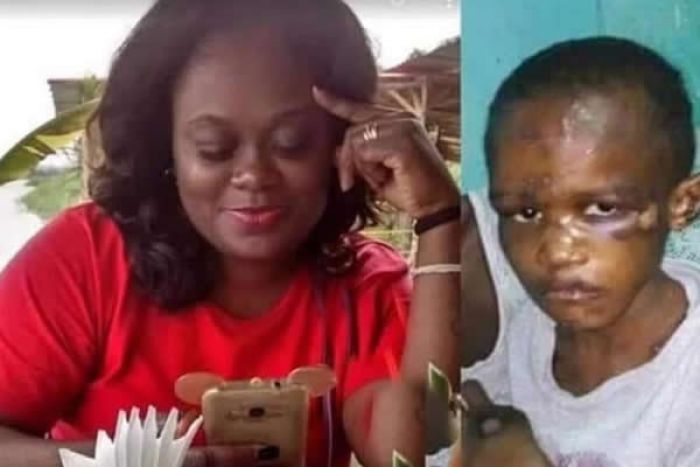 Polícia Nacional expulsa inspectora-chefe que agrediu filha adoptiva até a deixar desfigurada