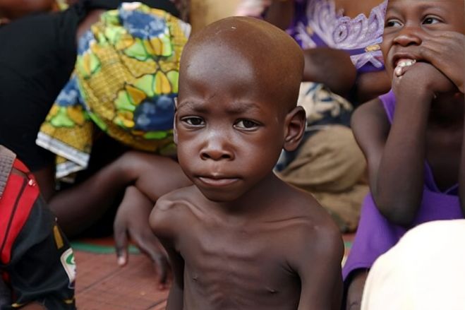 Quatro em dez crianças angolanas com menos de 5 anos sofrem desnutrição crónica