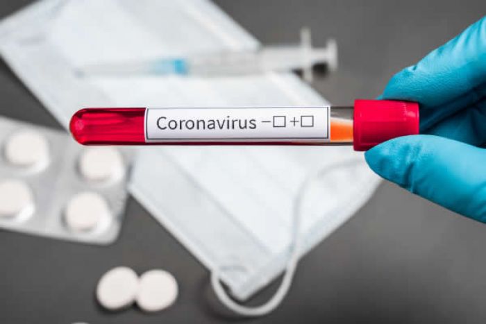 Número de casos positivos em Angola aumenta para 17