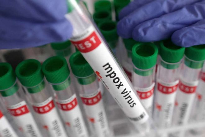 Angola descartou casos suspeitos de mpox e continua livre do vírus