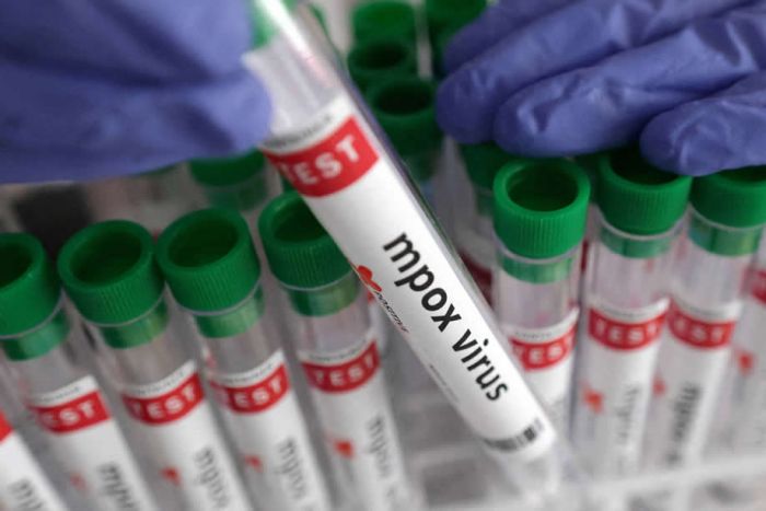 Angola descartou casos suspeitos de mpox e continua livre do vírus